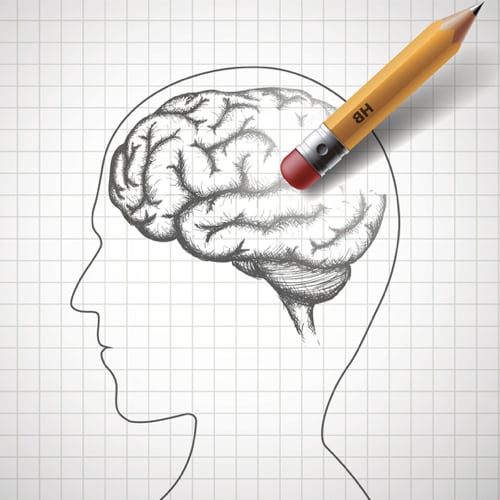 ألزهايمر