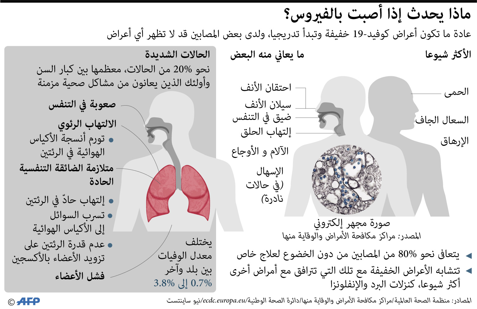 ال