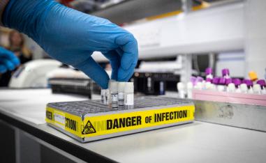 Technician extracts viruses samples at the novel coronavirus testing laboratory at Glasgow Royal Infirmary, Scotland