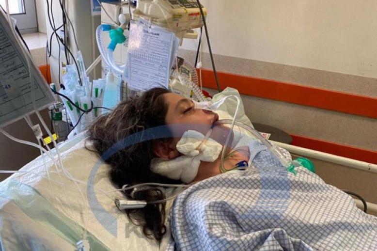 مهسا أميني دخلت في غيبوبة بعد ساعتين فقط من اعتقالها والسلطات تدعي اصابتها بنوبة قلبية ودماغية
