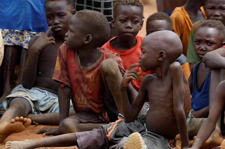 Malnourished kids in Sudan