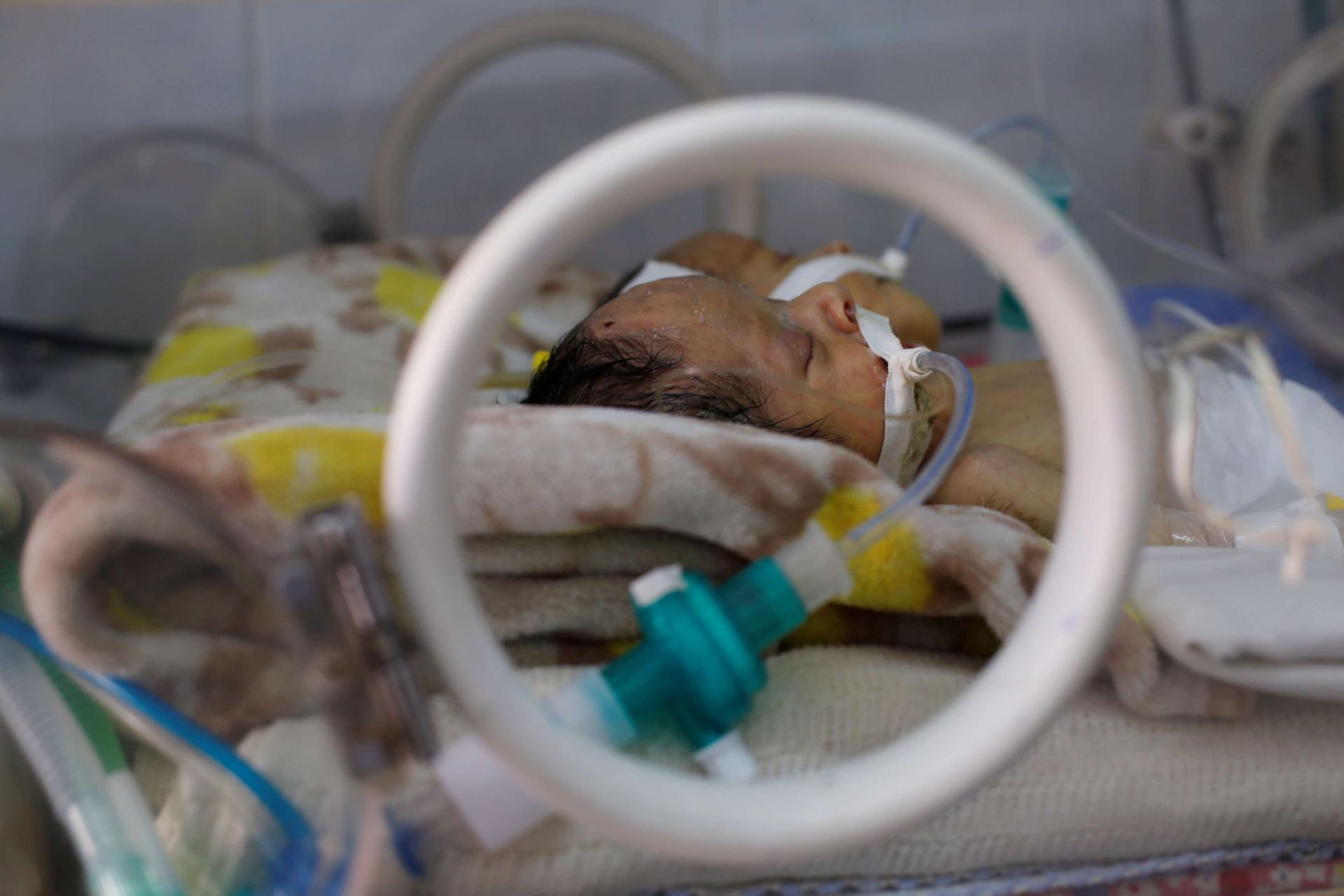 Health services have collapsed as the conflict has ground on and most hospitals are not equipped to provide specialist treatment