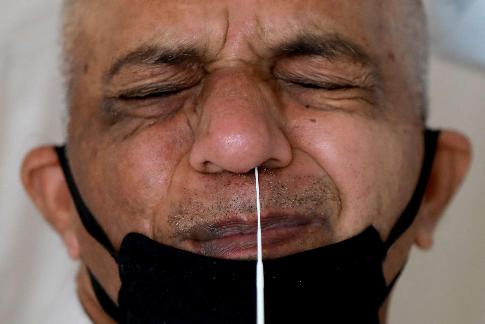 طبيب يأخذ مسحة من أنف شخص مشتبه باصابته بفيروس كورونا