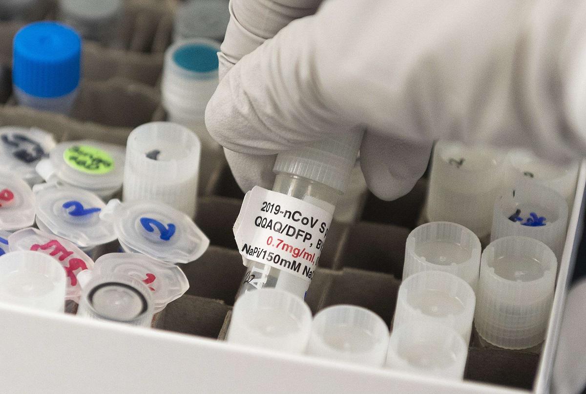عينات من لقاح محتمل لكورونا تطوره جامعة أوكسفورد
